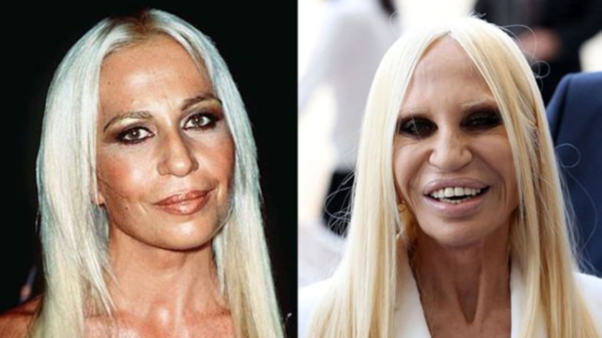 ¡ QUE MIEDO ! El antes y después de una mala cirugía