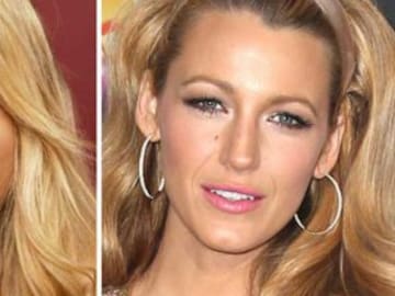 Famosas antes y después de sus cirugías en solo 15 fotografías Sus operaciones resultan ser un éxito completo que pasa desapercibido