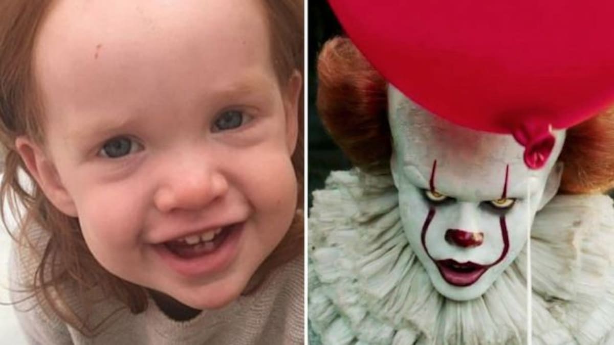 Niña termina como Pennywise tras ponerse crema de depilar en la cabeza