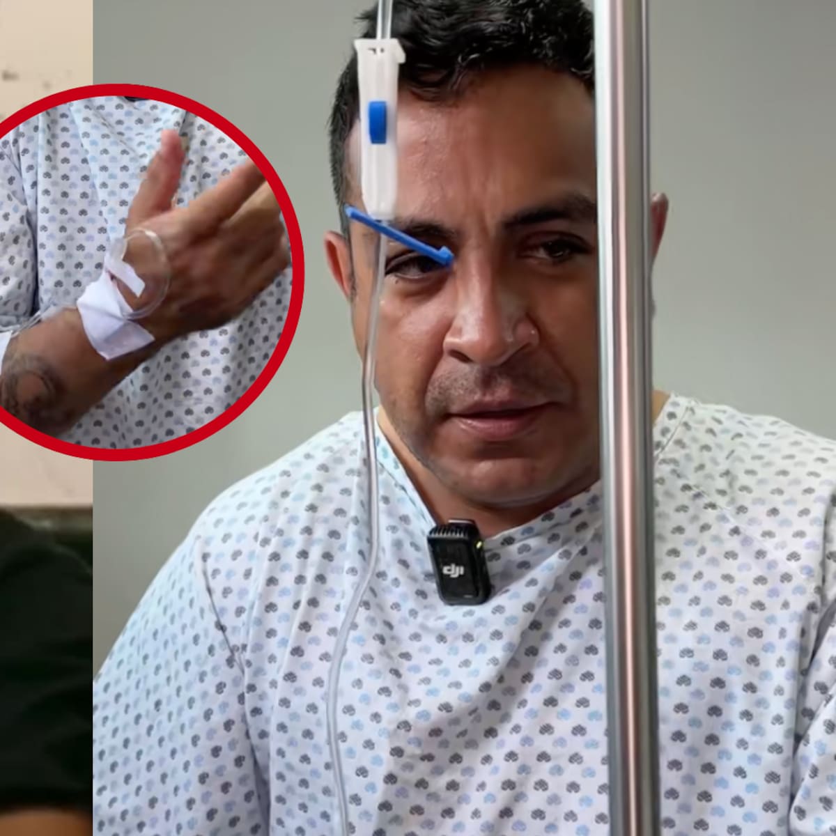 El actor de "Amarte Duele" habló sin filtros sobre la cirugía íntima que cambió su vida ¿De cuál se trata?