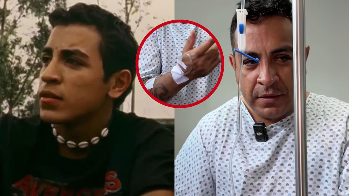 El actor de "Amarte Duele" habló sin filtros sobre la cirugía íntima que cambió su vida ¿De cuál se trata?