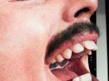 ¿Por qué Freddie Mercury nunca quiso alinear sus dientes?