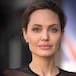 Así lucía la chica que se operó para parecerse a Angelina Jolie