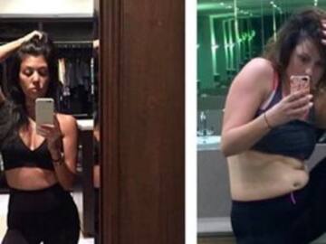 "Selfies", problema de autoestima