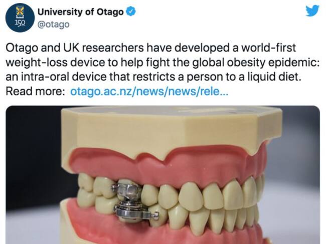 Aparato para bajar de peso consiste en cerrar los dientes con una especie de candado