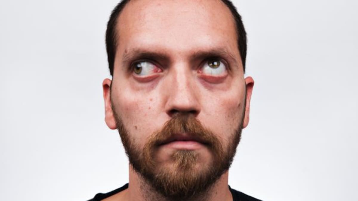 El exceso de celular te puede dejar así