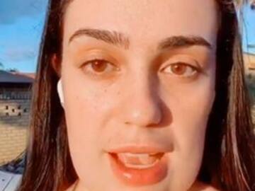 Se hace cirugía para quitarse la papada y le queda cuadrada