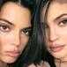 FOTO DE LAS JENNER TE HARÁ NOTAR TODAS SUS CIRUGÍAS