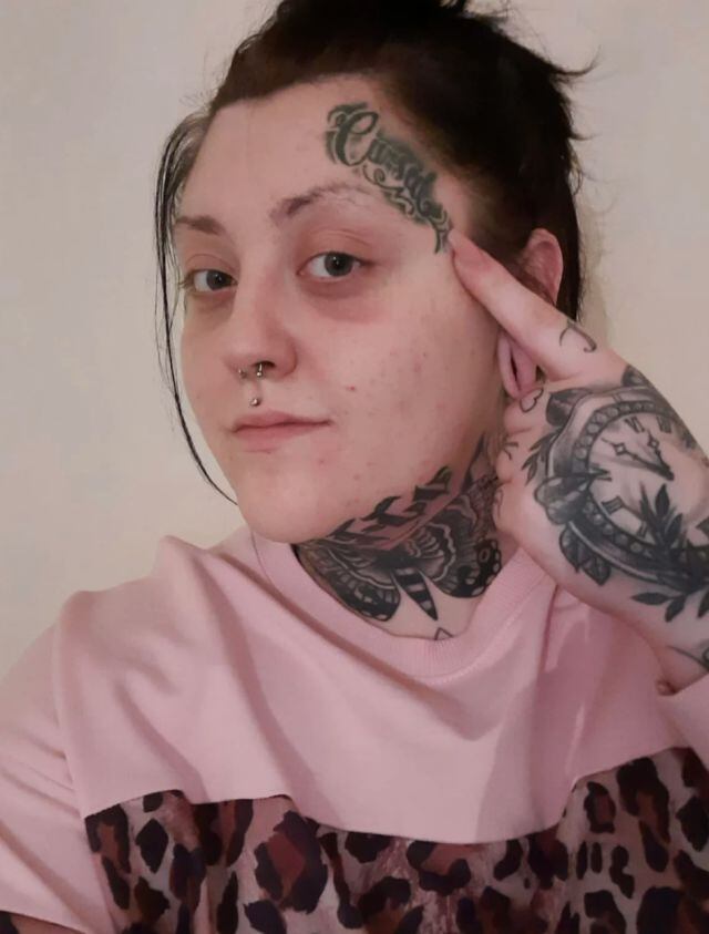 Aún con maquillaje es muy difícil de ocultar