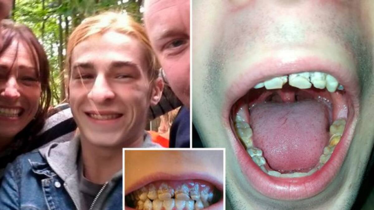 Perdió los dientes por su adicción a esta bebida