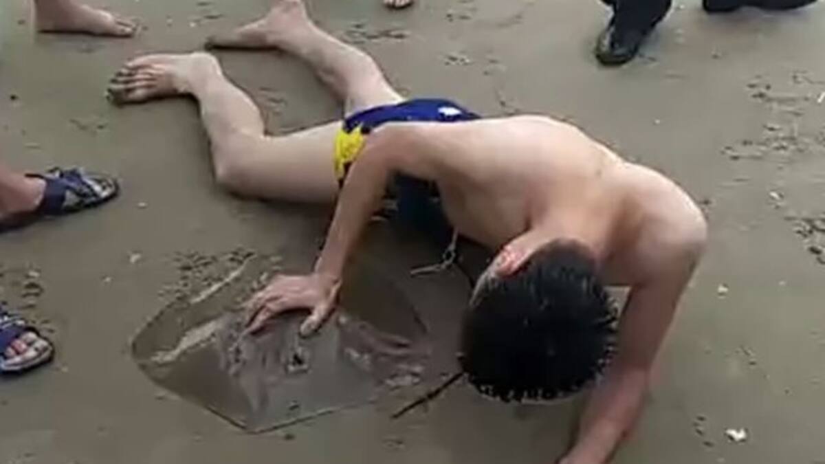 Sale del mar con una mantarraya pegada a sus partes íntimas