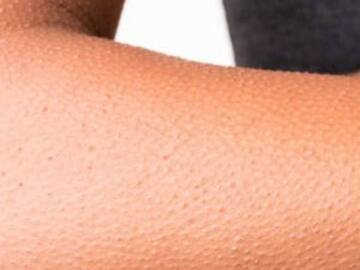 #Top Ten: Se me enchina la piel cuando…