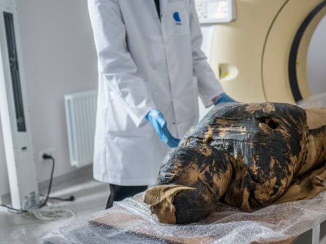 La momia pasó mucho tiempo en el museo y no se habían dado cuenta del bulto que tenía en el vientre