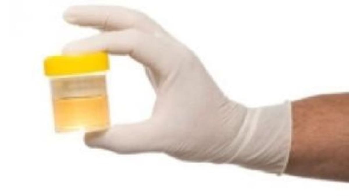 Arrestan a un hombre adicto a tirarle orina a las mujeres