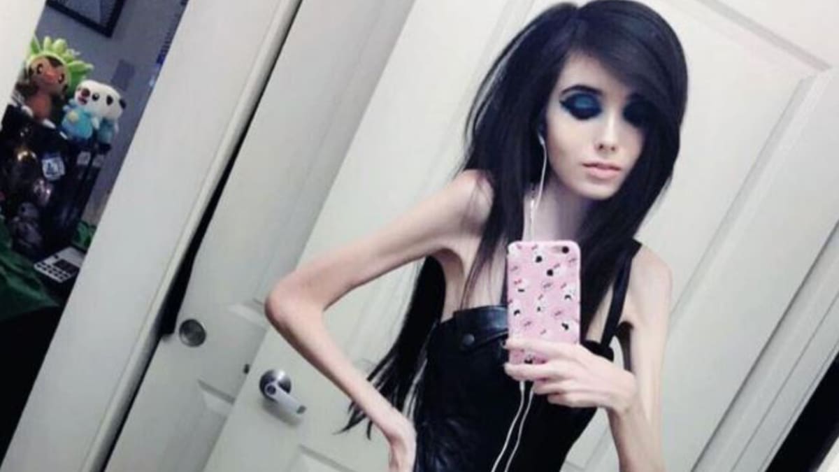 Anorexia y bulimia en 2026: ¿desaparecieron estas enfermedades o solo cambiaron de forma en la era digital?